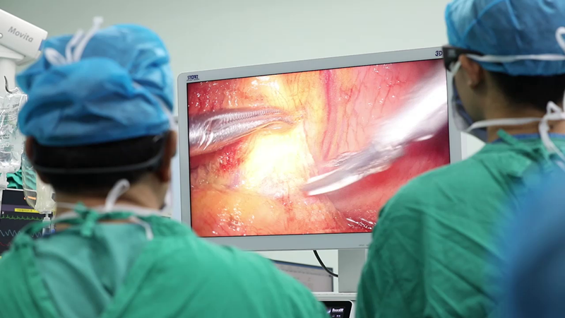 腹腔镜手术 腹腔镜手术